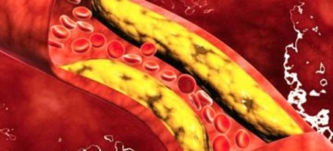 Анализ крови на липопротеин