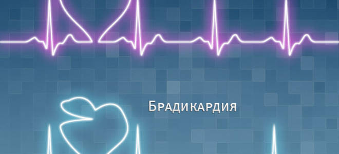 Брадикардия и потливость