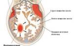 Гематома в голове после удара симптомы