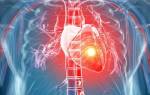 Диагностика и лечение инфаркта миокарда клинические рекомендации