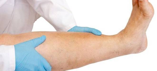 Венам крем инструкция по применению