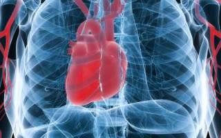 Гомеопатия при аритмии сердца