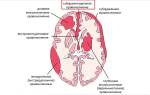 Арахноидальное кровоизлияние в мозг последствия