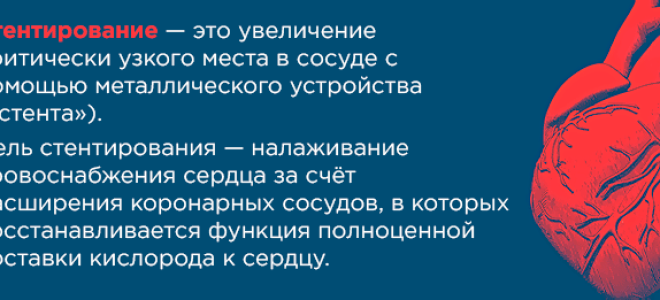 Замена стента в сердце