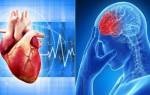 Как избежать инфаркта и инсульта при ишемической болезни сердца