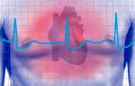 Аритмии сердца и блокады экг