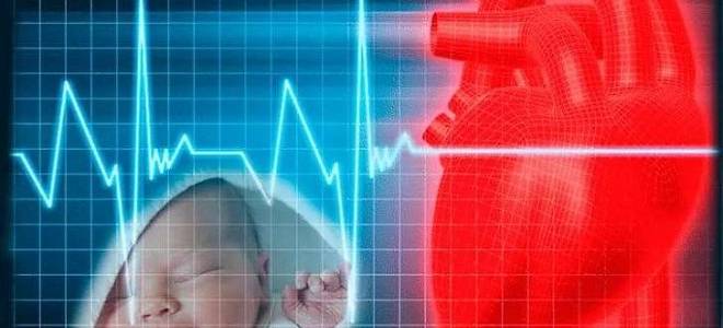 Дефект межжелудочковой перегородки клинические рекомендации