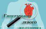Гипертония левого желудочка сердца
