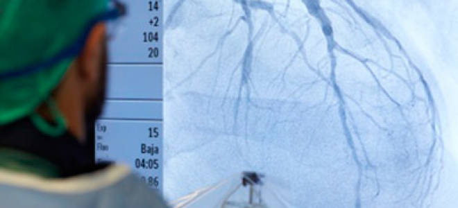 Инфаркт как проводится операция