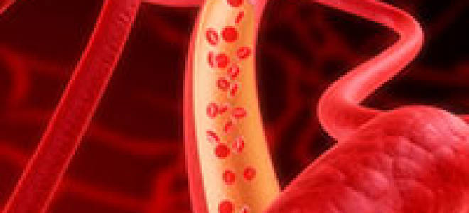 Как вылечить сасуды