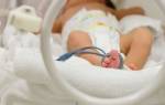 Гипоксия новорожденного симптомы и последствия