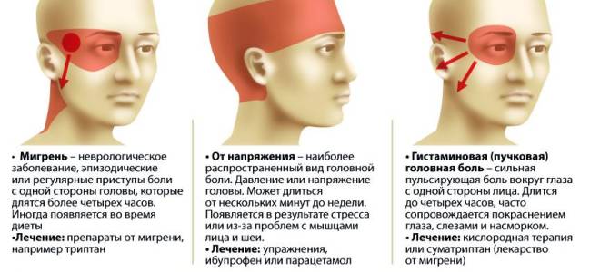 Из за чего может болеть затылок