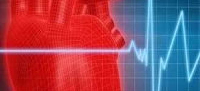 Дифференциальная диагностика мерцательной аритмии