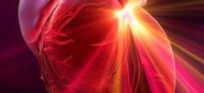 Жалобы при остром инфаркте миокарда