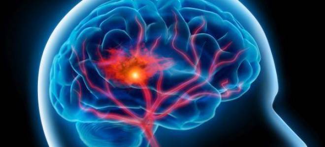 Дисциркуляторная энцефалопатия 1 степени