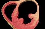 Аневризма аорты сердца у детей